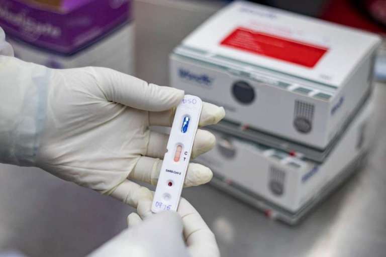 No Ceará, 71% dos infectados pelo coronavírus estão curados, Estado segue em alerta para possível 2ª onda